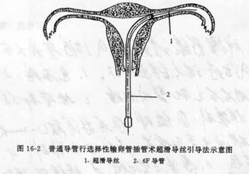 �����в����ĸ������ѹܽ������ơ�