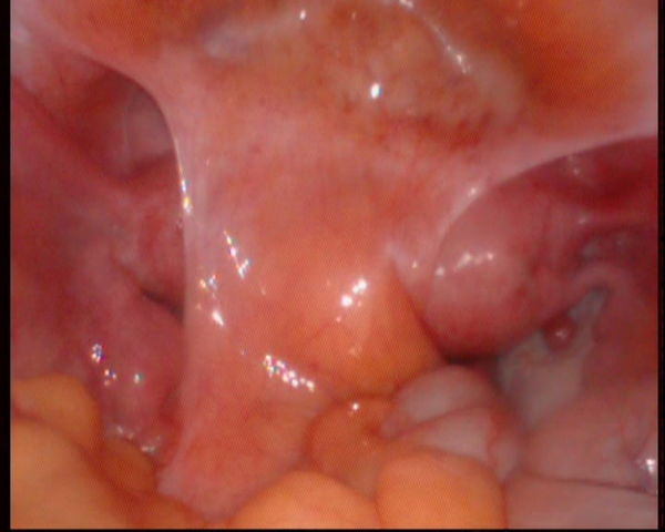 ������ǻ������˫���ӹ���������