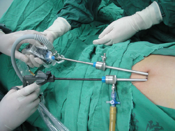 ������˫ͨ����ǻ�������ھ�����λ��������