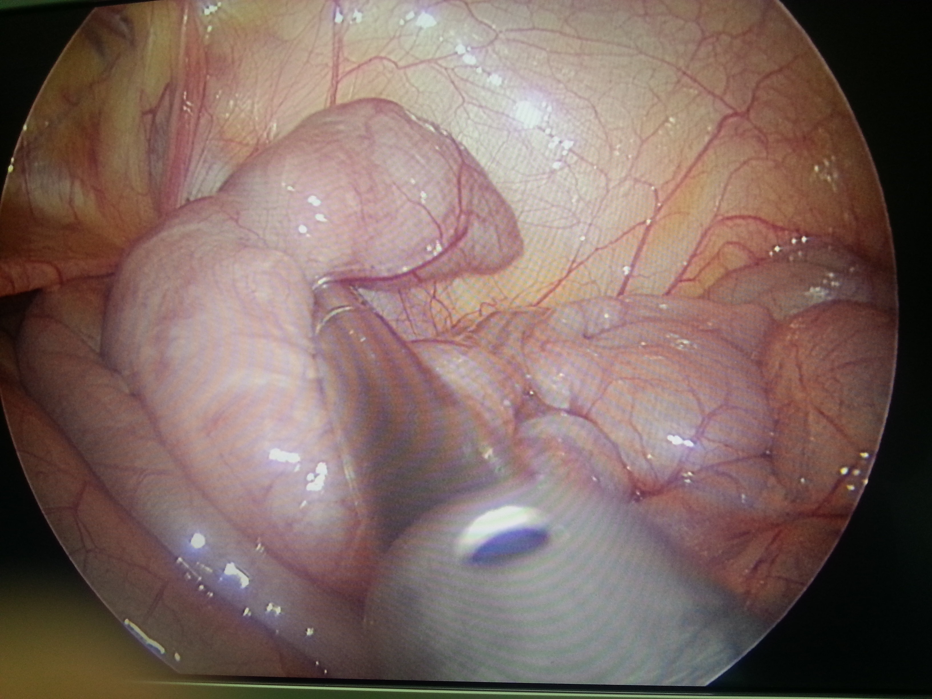 �����������˶����ҡ�