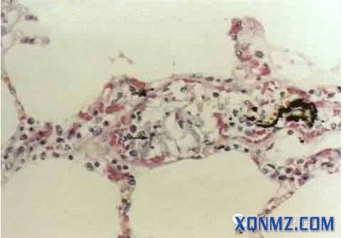 ����ˮ˨���������������Ρ�ɱ�֡���