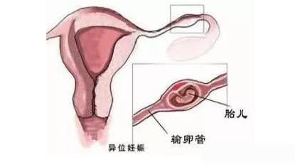 ����ɹ����е�ԭ�����������