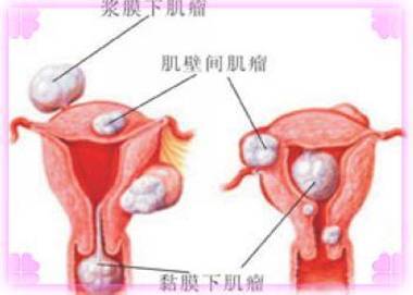 ��ճĤ���ӹ�������