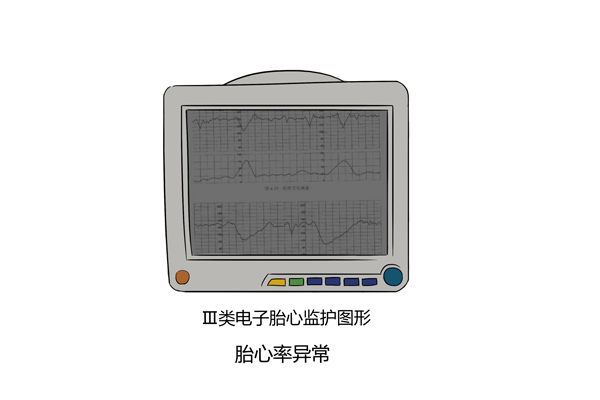 �������ж�̥���Ƿ�ȱ����